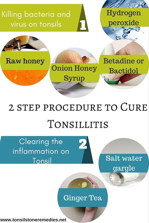 2 step procedure to cure Tonsillitis naturally - Best remedy