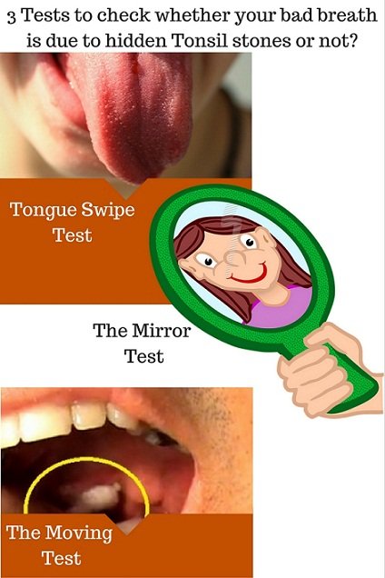 tests to know whether your bad breath is because of tonsil stones or not