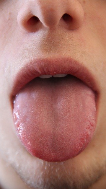 tongue test tonsil stone symptoms