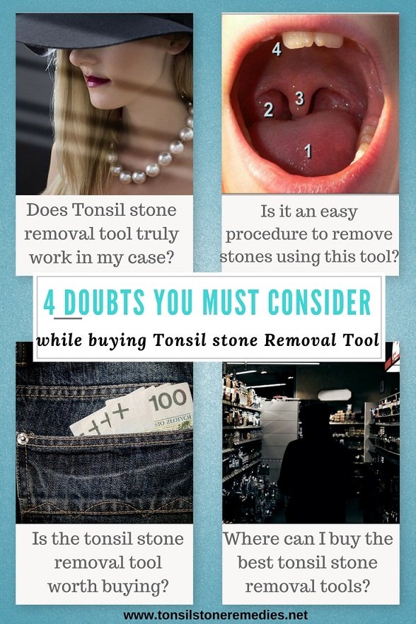 4 doubts you must consider while buying Tonsil stone Removal tool