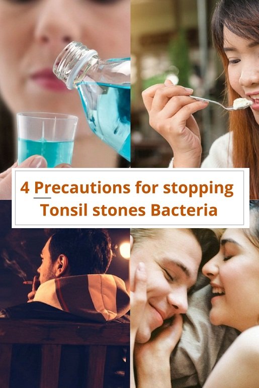 Are Tonsil stones contagious? Also what about tonsil stones bacteria?