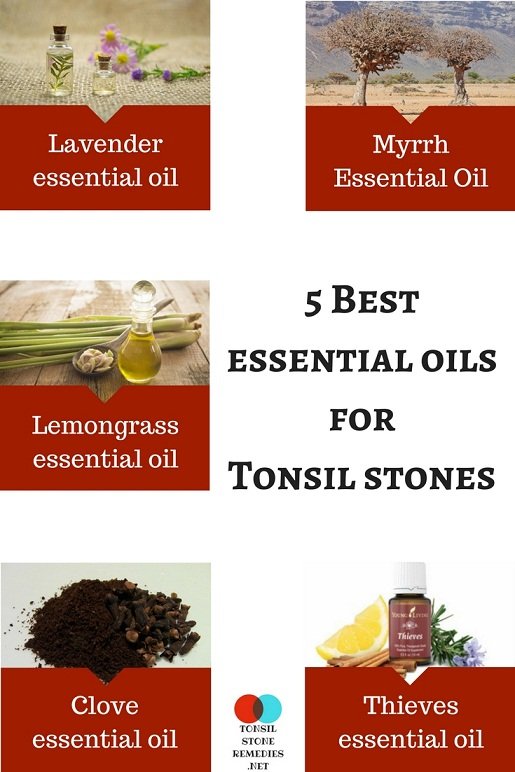 5 Best essential oils for Tonsil stones: How to use them?