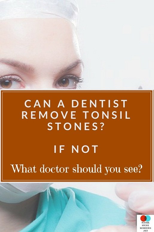 Can a Dentist remove Tonsil stones? If not what doctor should you see?
