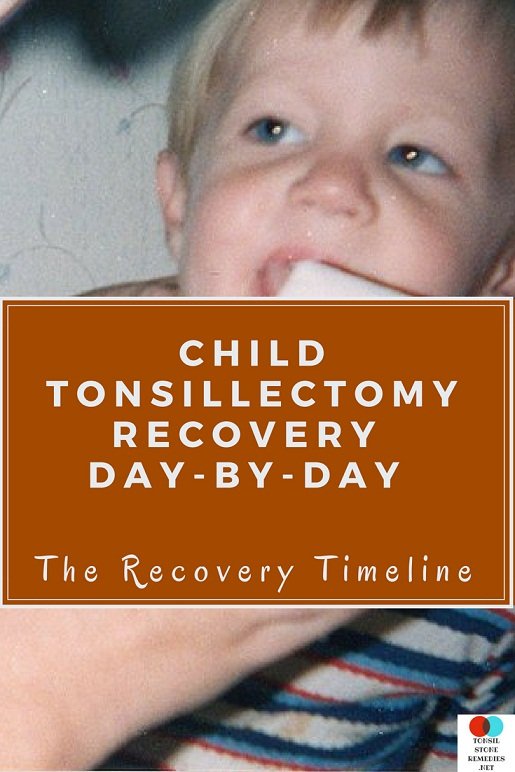 Child Tonsillectomy recovery Day by Day: The Recovery Timeline