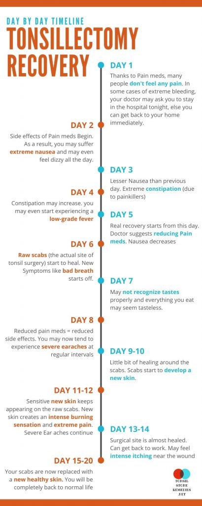 Adults Tonsillectomy Recovery Day by Day timeline (Research-backed)