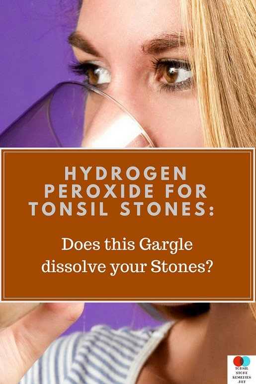 Hydrogen peroxide for Tonsil stones: Does this Gargle dissolve your stones?