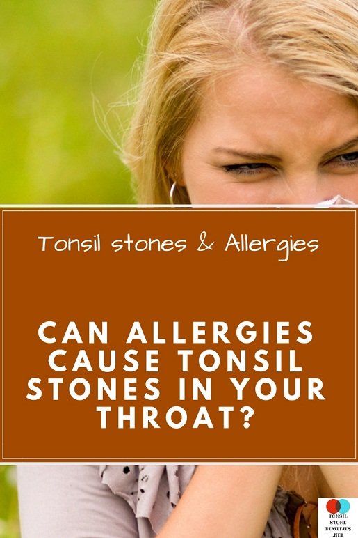 Tonsil stones & Allergies: Can allergies cause Tonsil stones in your throat?