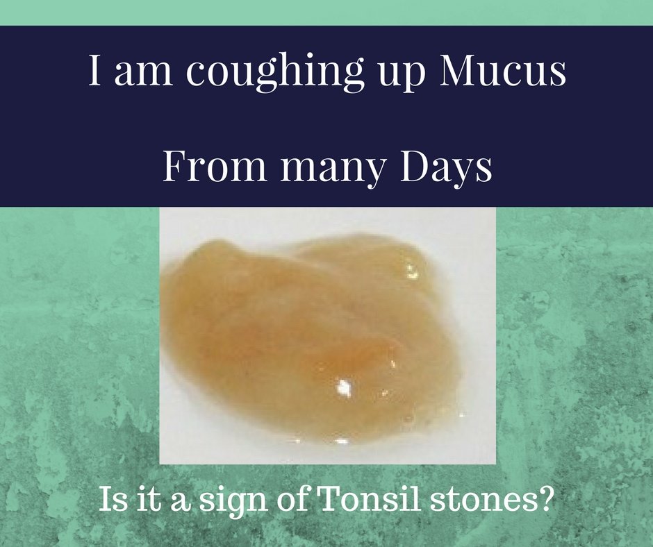 i-am-coughing-up-mucus-from-many-days