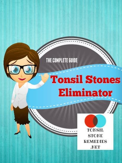 Tonsil stones eliminator