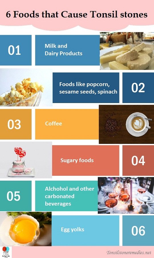 6 Foods that cause Tonsil stones Here is the List you must avoid