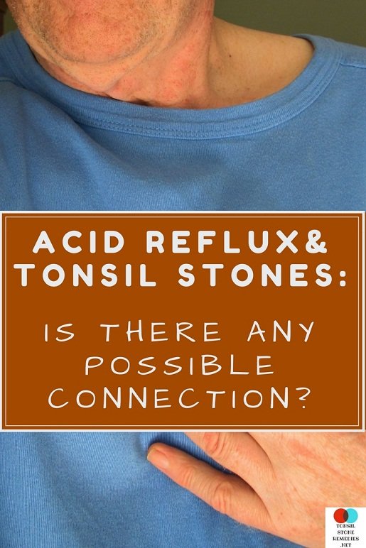 acid-reflux-tonsil-stones-is-there-any-possible-connection