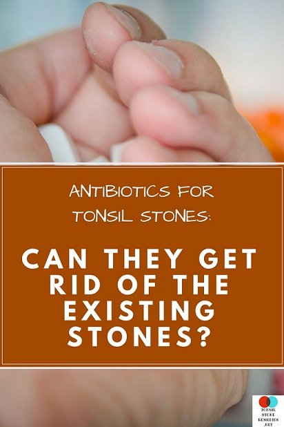 antibiotics-for-tonsil-stones-can-they-get-rid-of-the-existing-stones