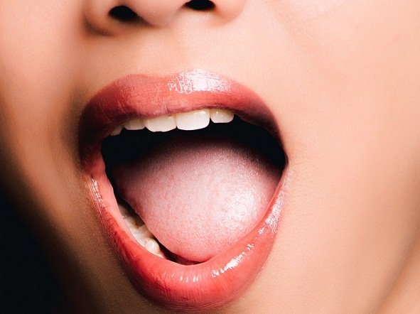 15+ Real Tonsillitis Pictures from Across the Web - This is How it looks like